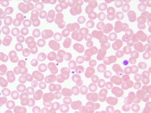 File:Blood-rbcs and thrombocytes2.jpg
