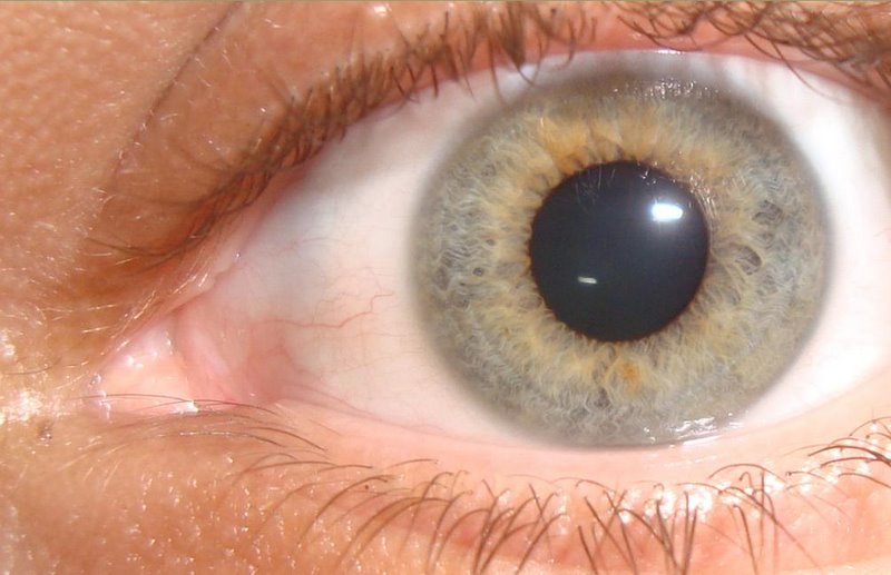 File:Color de ojos.jpg - Wikipedia
