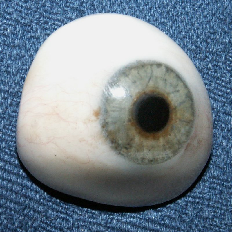 Prothèse oculaire — Wikipédia