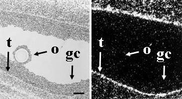 File:RNA-in-situ-dark-field.jpg