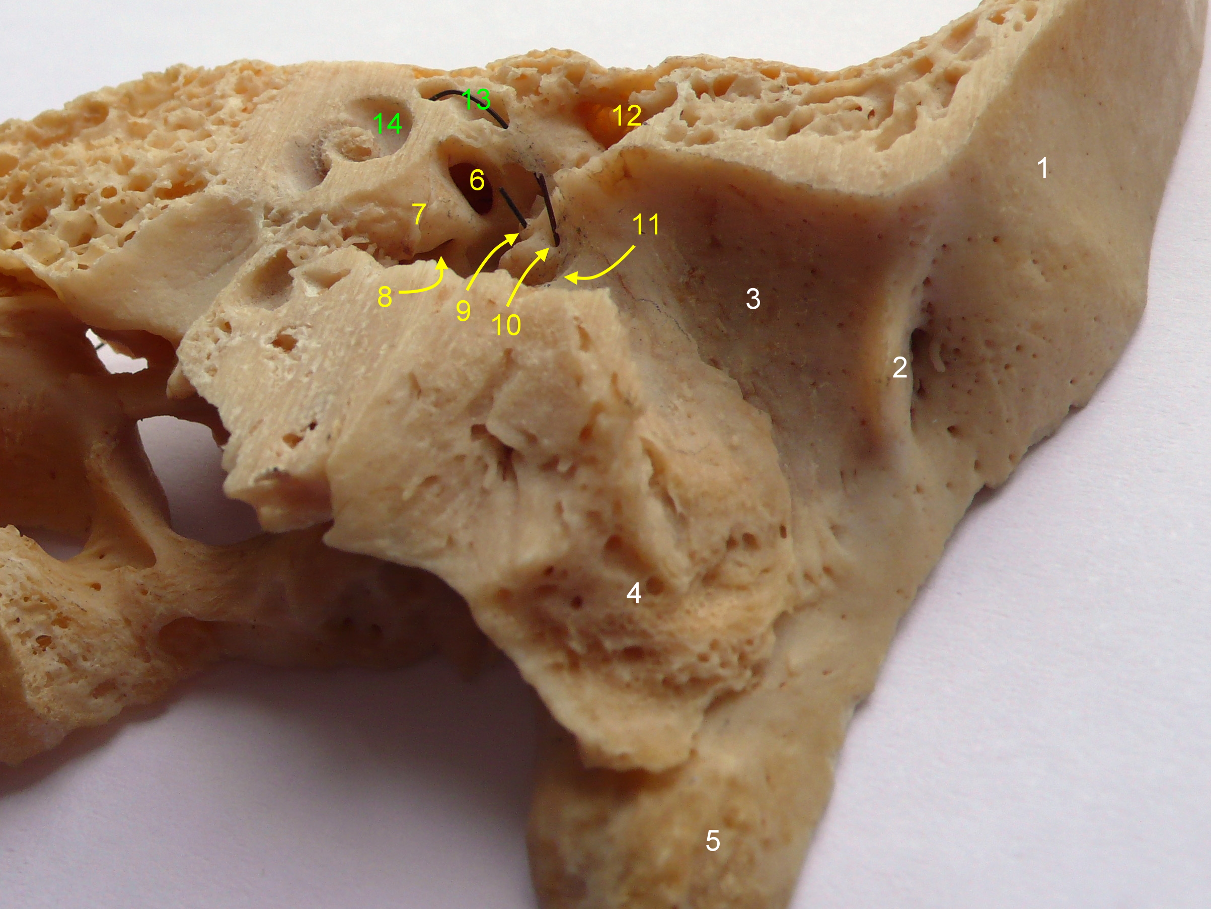 File:Mandibular nerve 3.jpg - Wikipedia