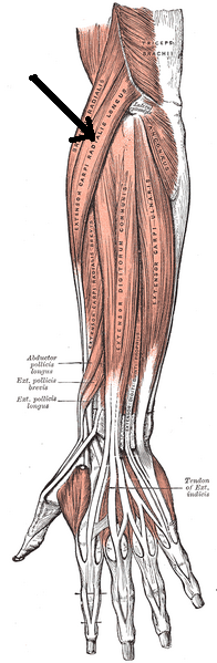 File:Hosszú orsócsonti csuklófeszítő izom.PNG