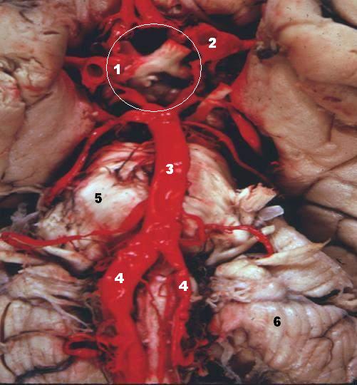 File:Human base of brain blood supply description.JPG