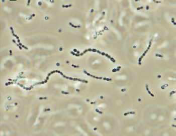 File:Streptococcus iniae.png