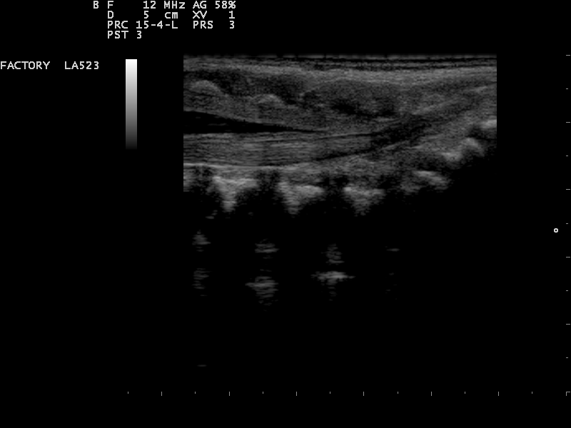 File:Ultrasound Scan ND 0117094426 0947020.png