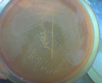 File:MacConkeys agar showing non-lactose fermenting colonies.JPG