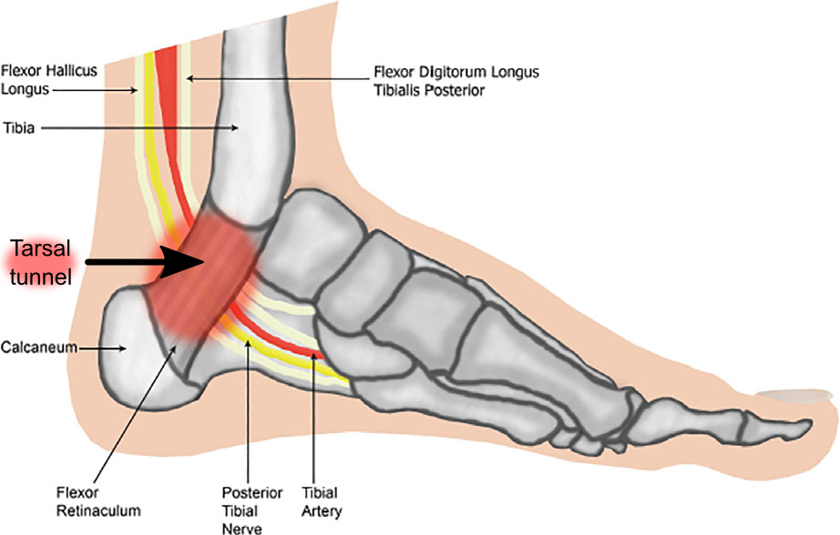 tibial posterior flexor digitorum longus flexor hallucis longus