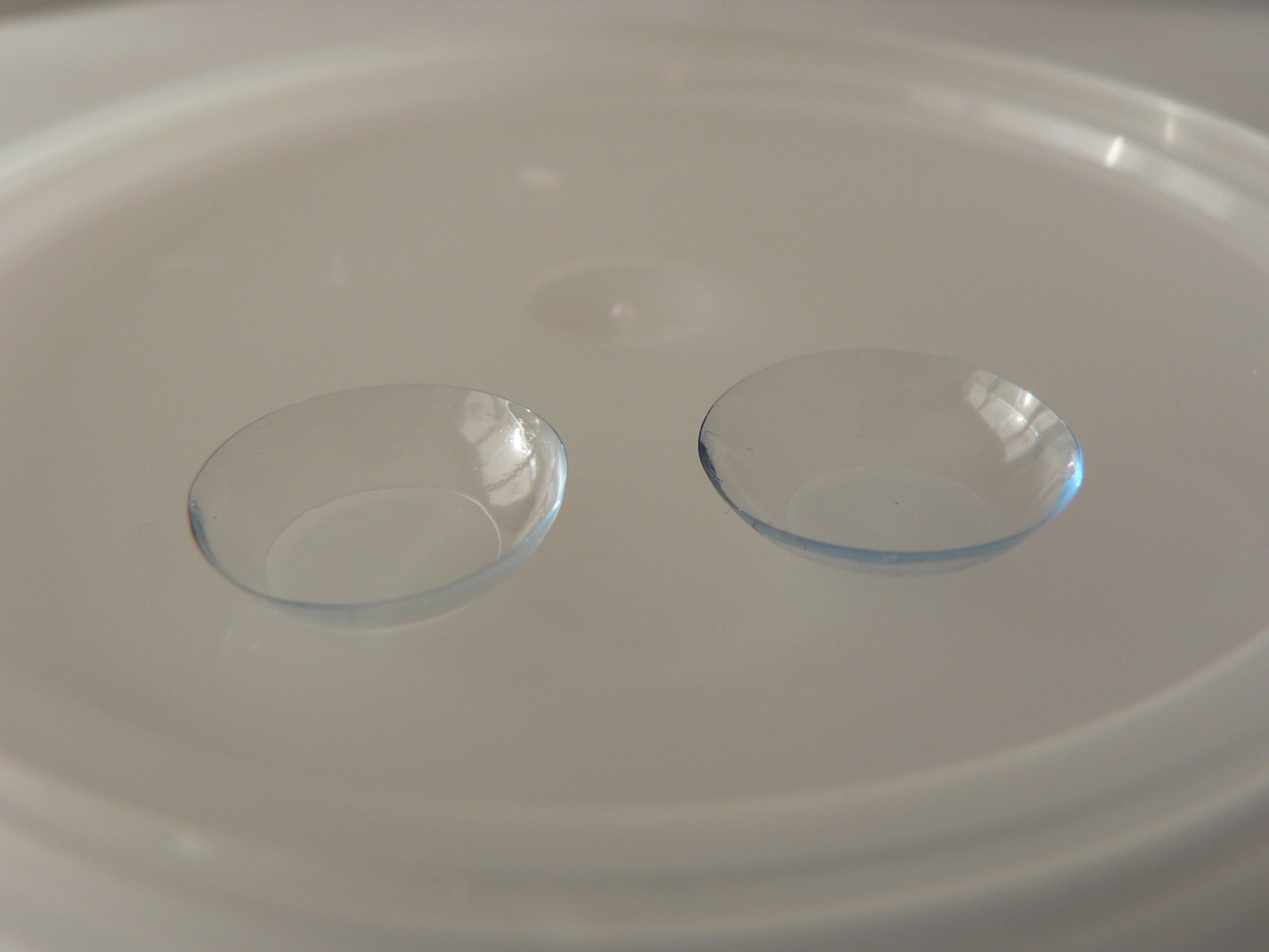 Contact Lens Spectrum - Contact Lens Case Reports