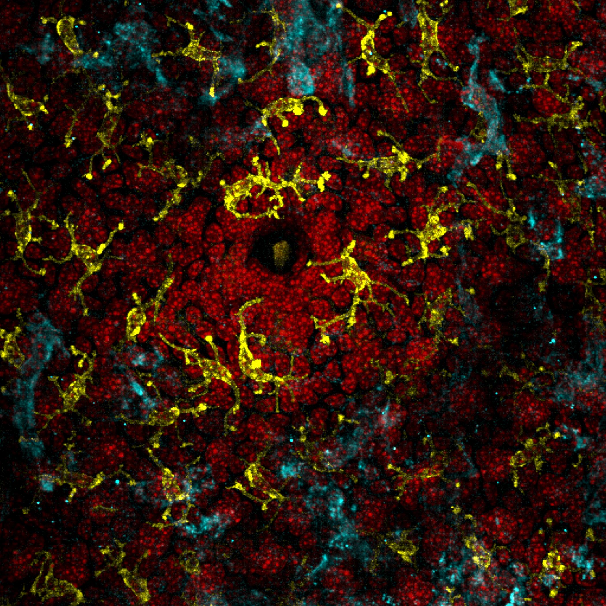 File:Immune Cells Surrounding Hair Follicles in Mouse Skin (7747051716).jpg  - Wikimedia Commons