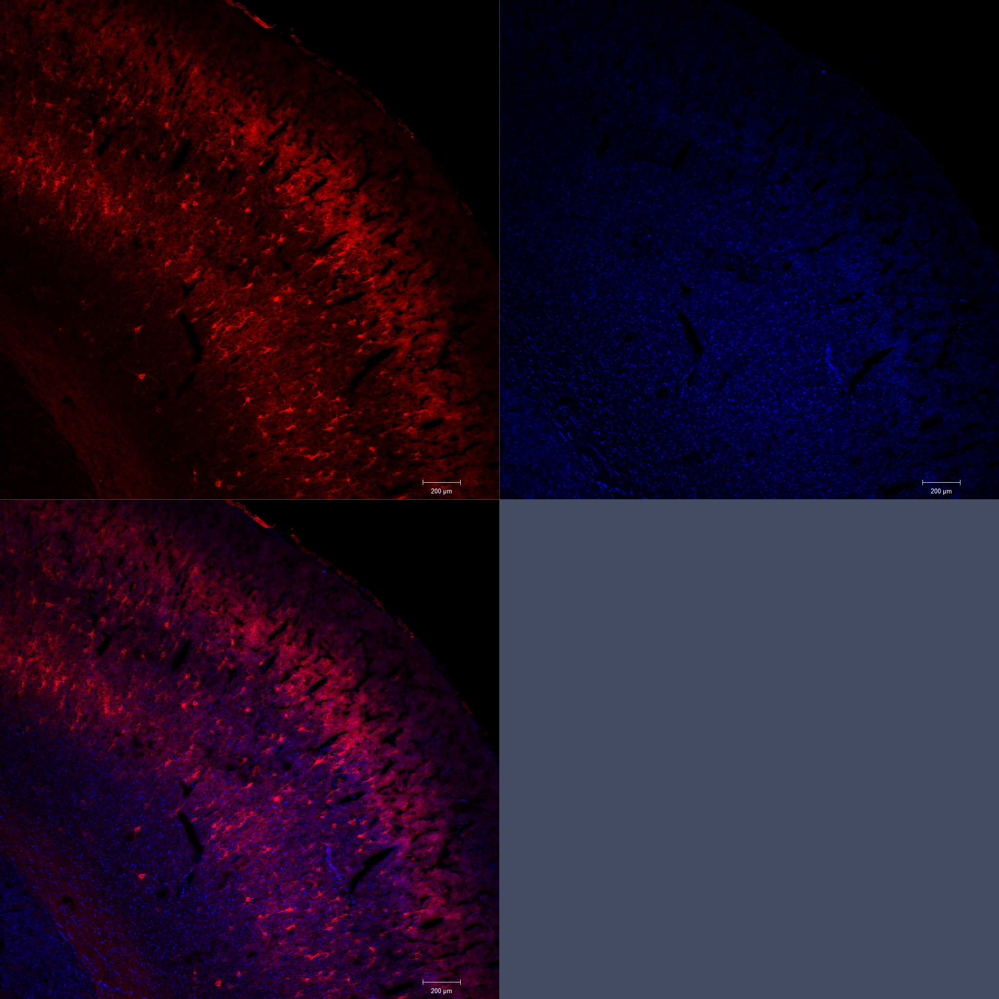 somatosensory cortex mouse