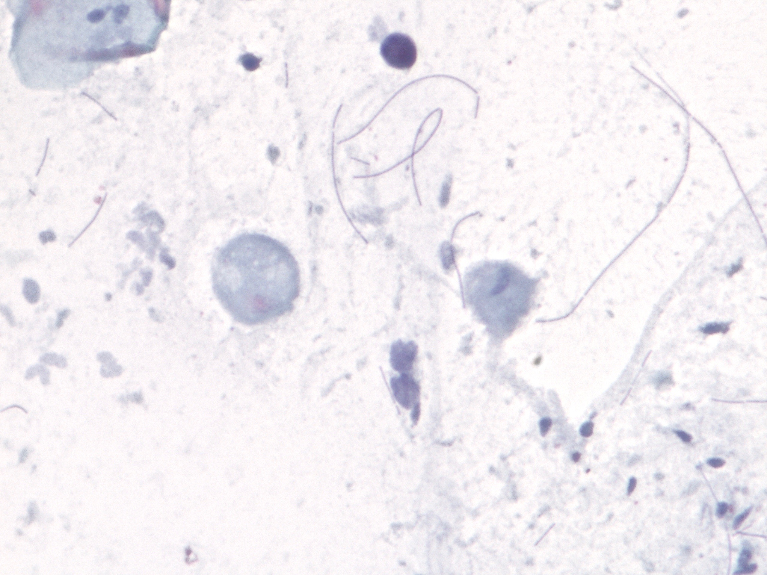 Cink trichomonas