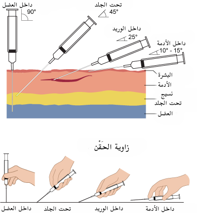 File:Needle-insertion-angles-1-ar.png