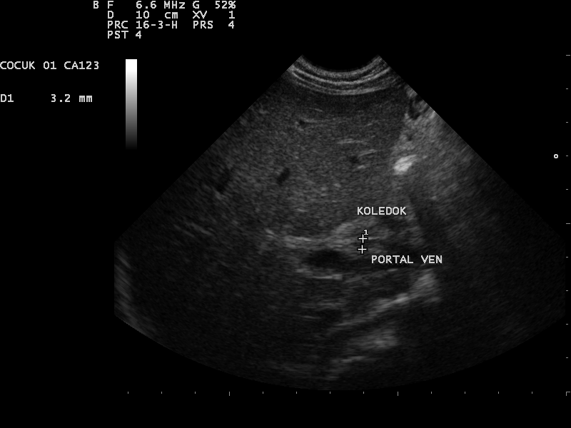 File:Ultrasound Scan ND 0112101745 1032090.png