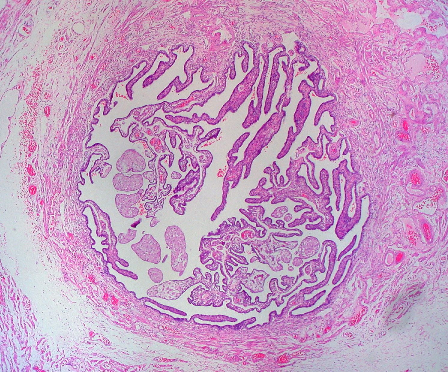 File:Normal Fallopian Tube, Human (2760475010).jpg - Wikimedia Commons