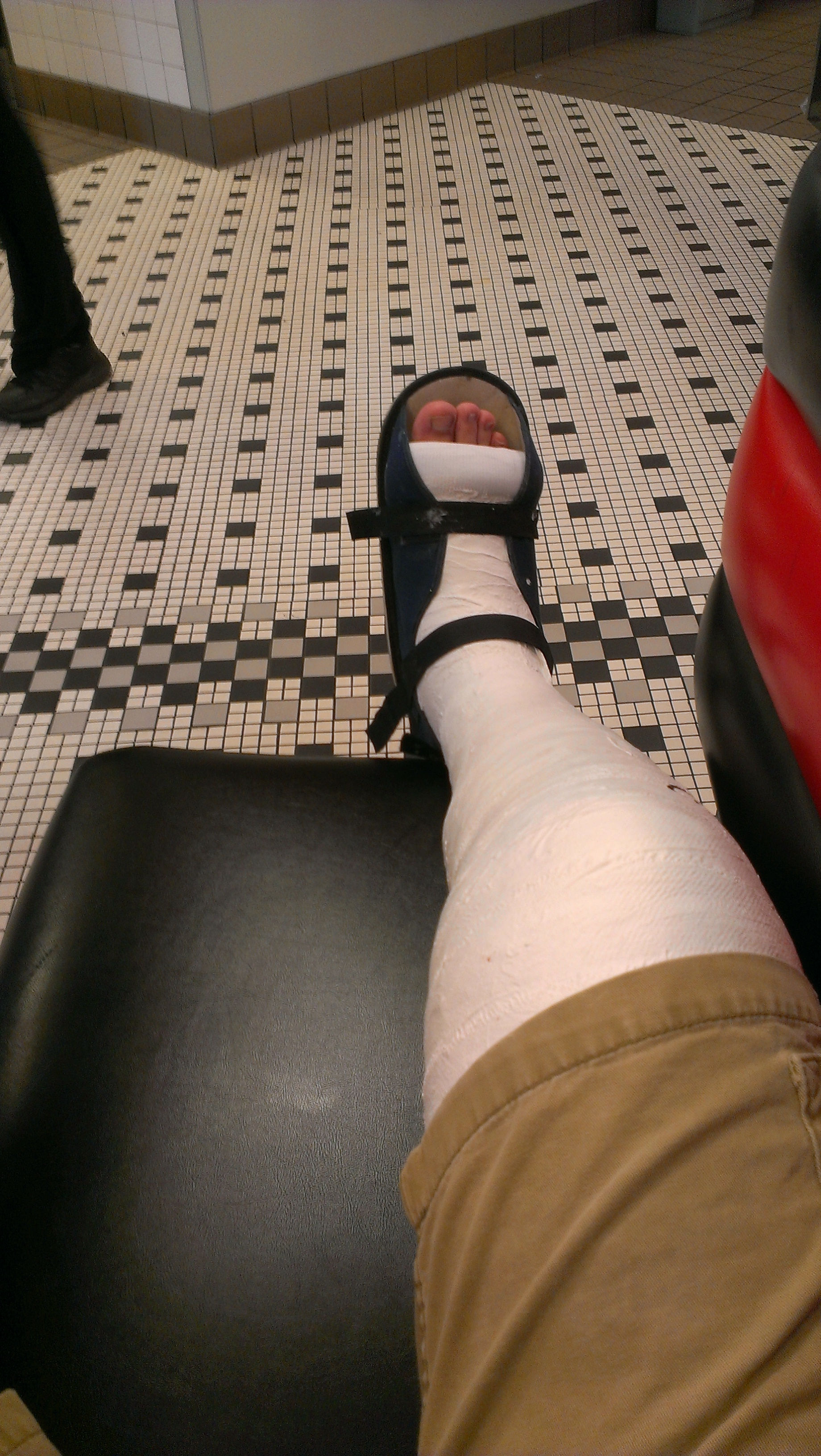 File:First plaster long leg cast..jpg - Wikimedia Commons