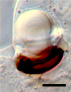 A micrograph of a single ocelloid; scale bar = 5 mm. Bmc evol bio hoppenrath proterythropsis ocelloid fig1e.png