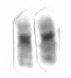 <span class="mw-page-title-main">Chromosome 19</span> Human chromosome