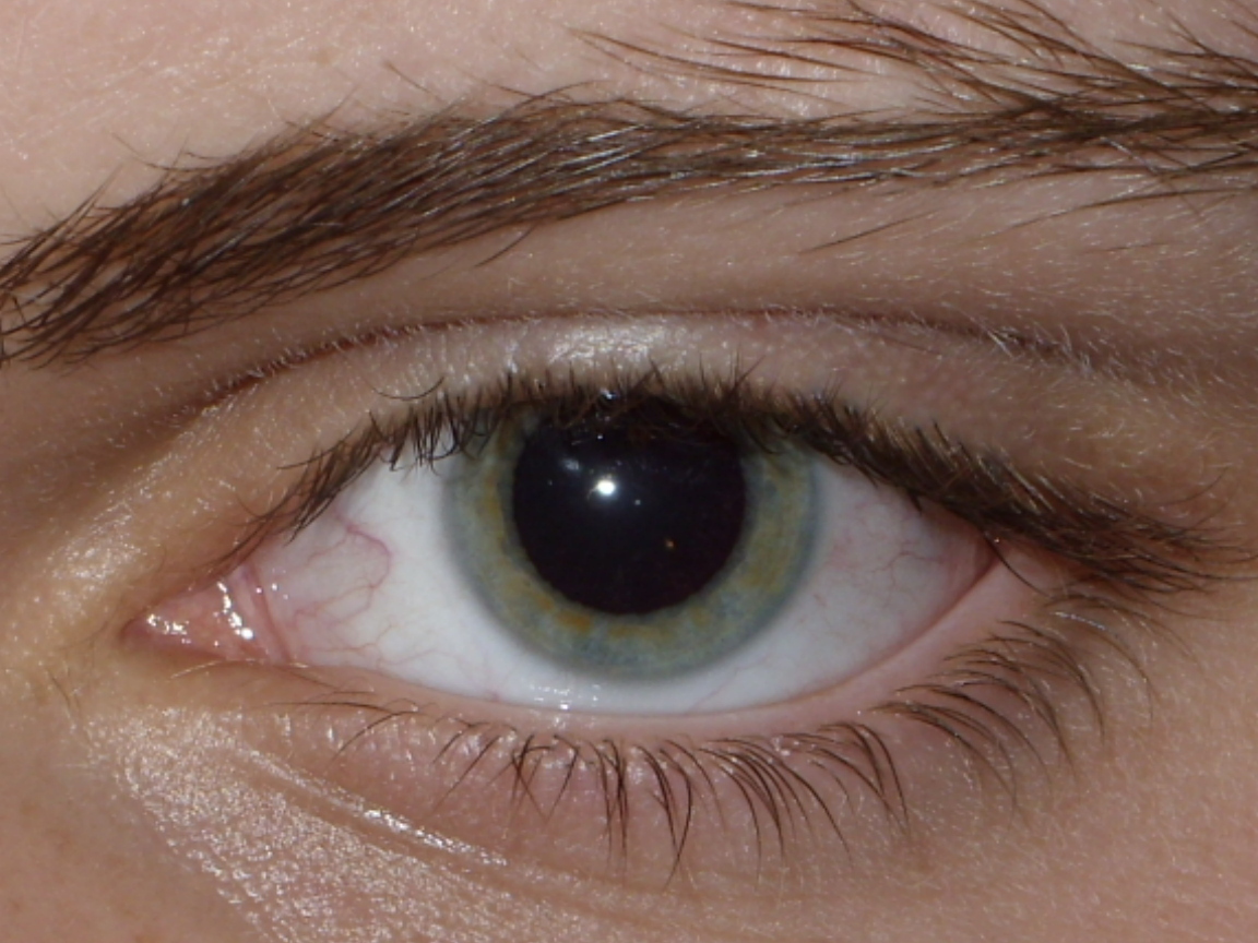 dilated pupils vs normal