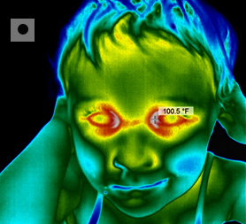 Infrared (IR) temperature measurement for fever screening correctly done at the medial canthus (tear duct) of the eye. Right Way To Do IR Fever Screening.jpg