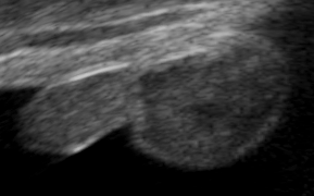 File:Ultrasound Scan ND 0107111200 1116060 cr.png