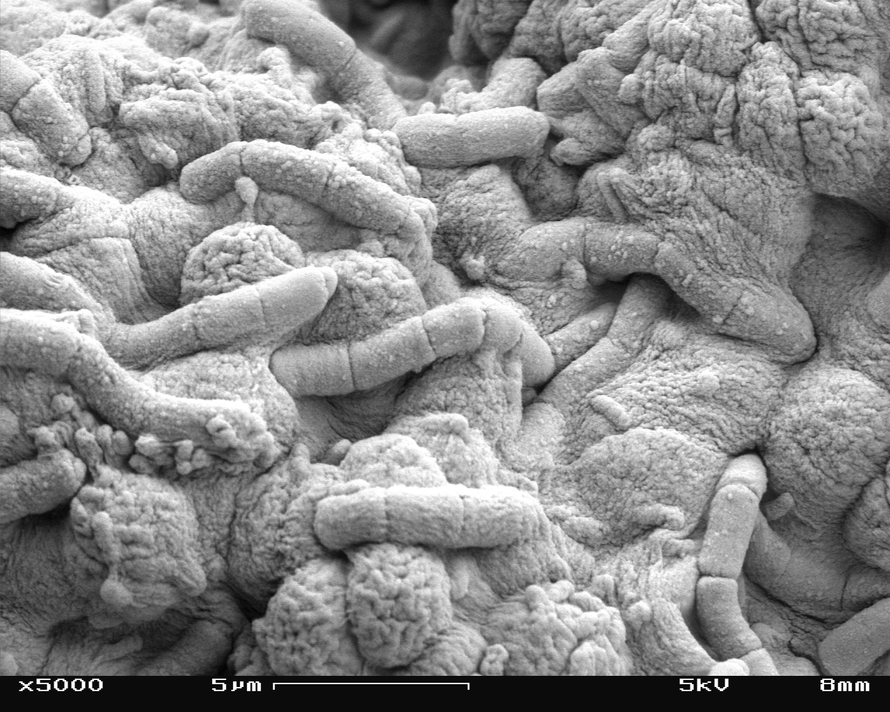 Filealgae And Bacteria In Scanning Electron Microscope Magnification