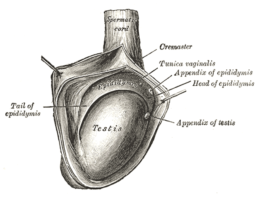 Hidrocele - Wikipedia, la enciclopedia libre