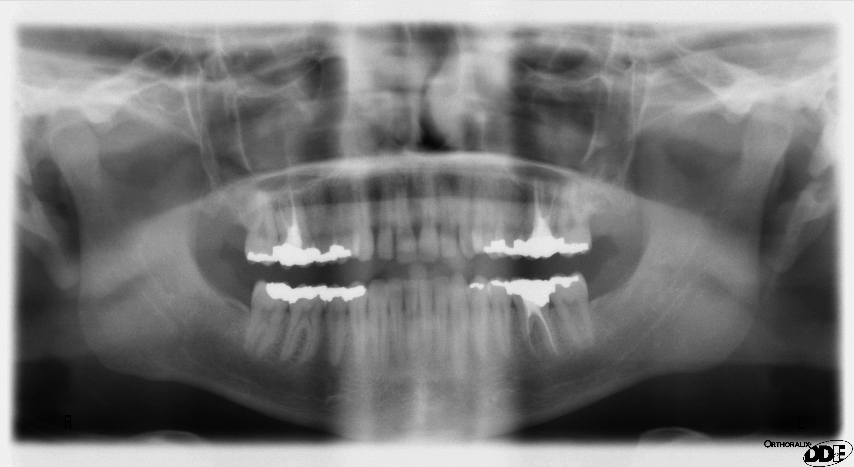 dental x ray film