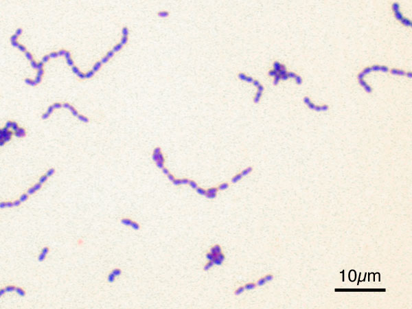 Streptococcus mutans. 