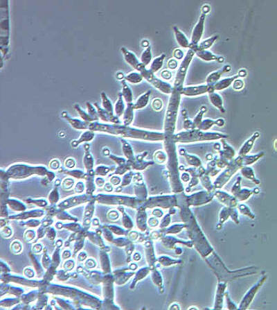 Conidioforen van Trichoderma harzianum, conidiogenese is blastisch-fialidisch