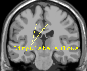 Cingulate sulkus.png