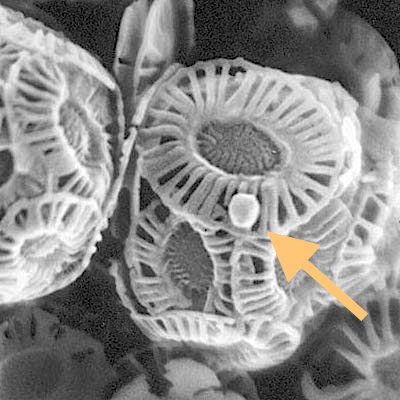 A giant coccolithovirus, Emiliania huxleyi virus 86 (arrowed), infecting an Emiliania huxleyi coccolithophore