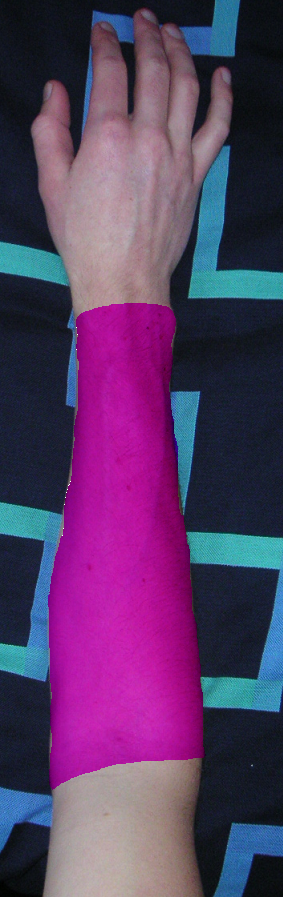 File:Forearm labeled.png