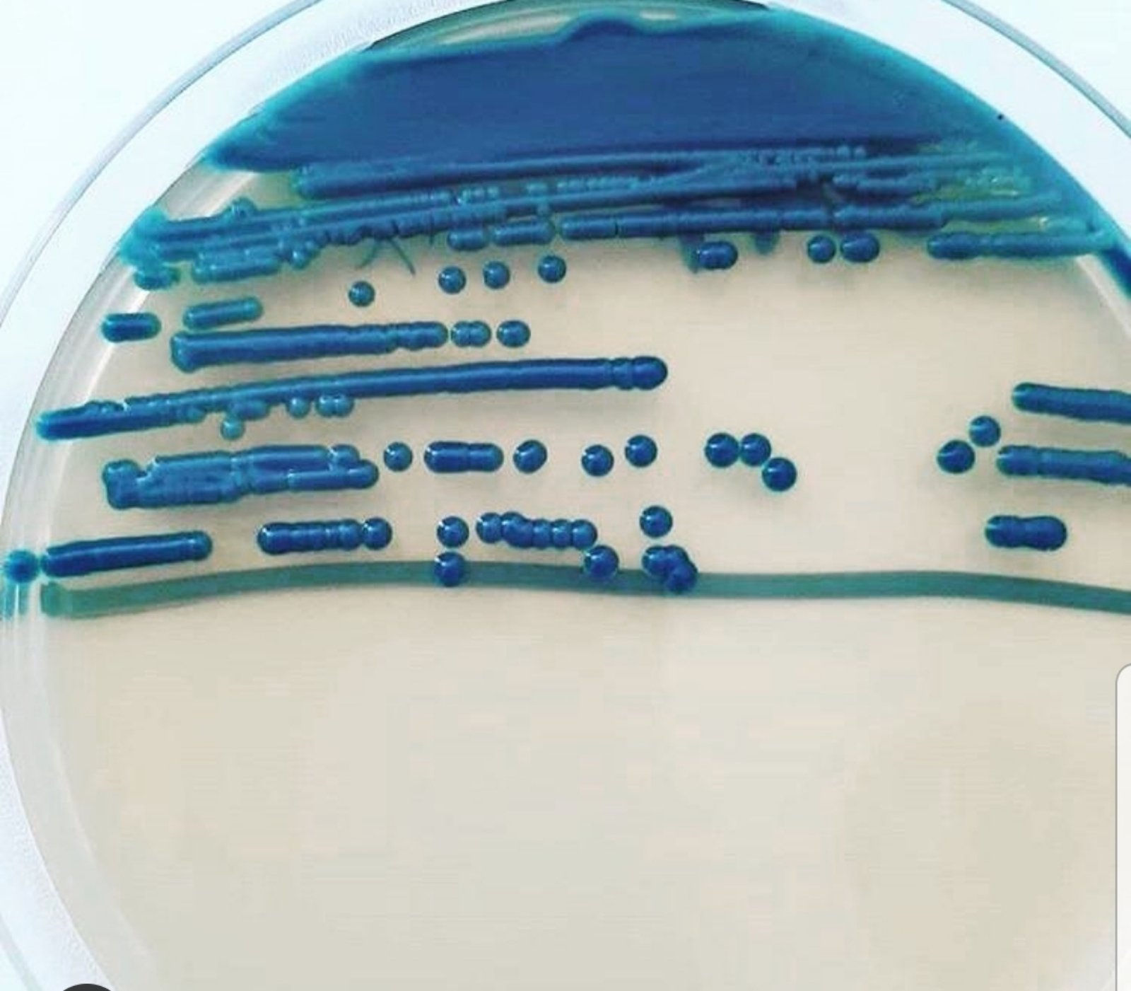 Klebsiella pneumoniae 10 5