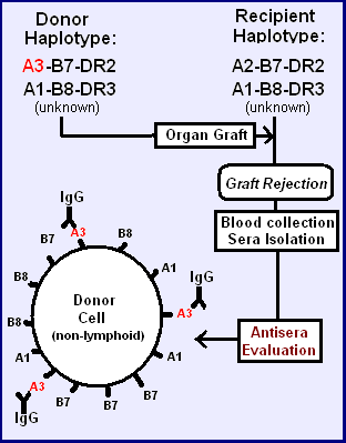 A simple example of HLA antigen causing rejection
A1, A2, B7, B8 do not cause reaction because they are in both donor and recipient, DR2 and DR3 are found on lymphoid cells Alloreactive Antisera.PNG