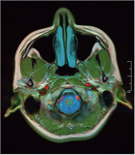 File:Color Brain MRI 0292 20.jpg