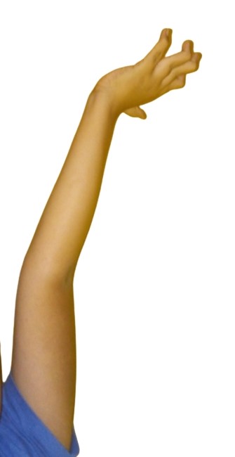 hyperextension arm