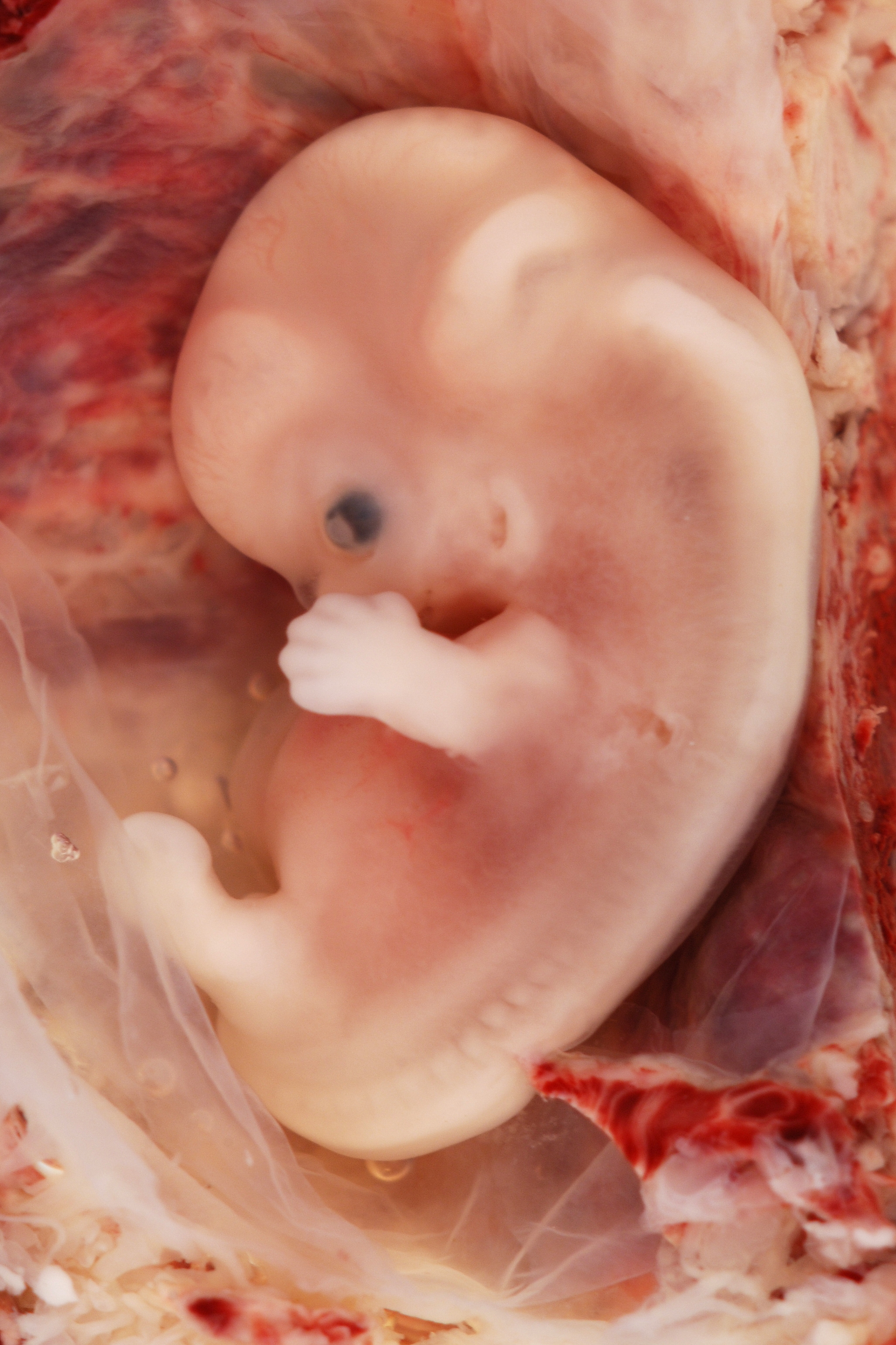 9 week old baby in womb