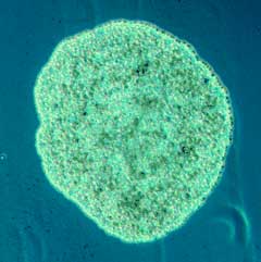 Placozoa, o animal mais solitário do mundo (Foto: Hunadam; CC BY-SA 3.0)