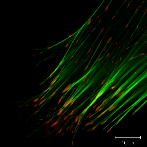 Immunofluorescentiekleuring van het actine-cytoskelet (groen) en het adhesieproteïne vinculine (rood) bij een fibroblastcel. De adhesieplaatsen zijn als rode vlekken aan de einden van de actine-bundel te zien.
