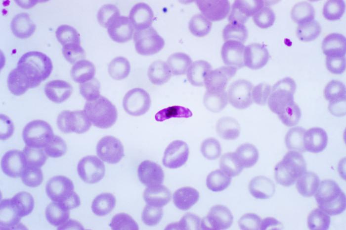 File:Macrogametocyte of the parasite Plasmodium falciparum PHIL 2701 lores.jpg