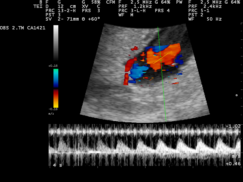 File:Ultrasound Scan ND 0118153223 1544580.png