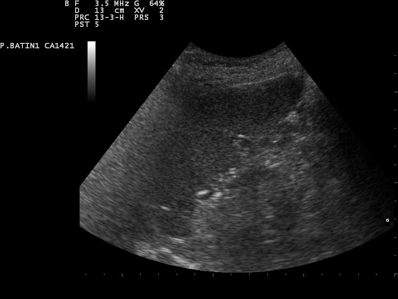 File:Ultrasound Scan ND 110218142340 1425010.jpg