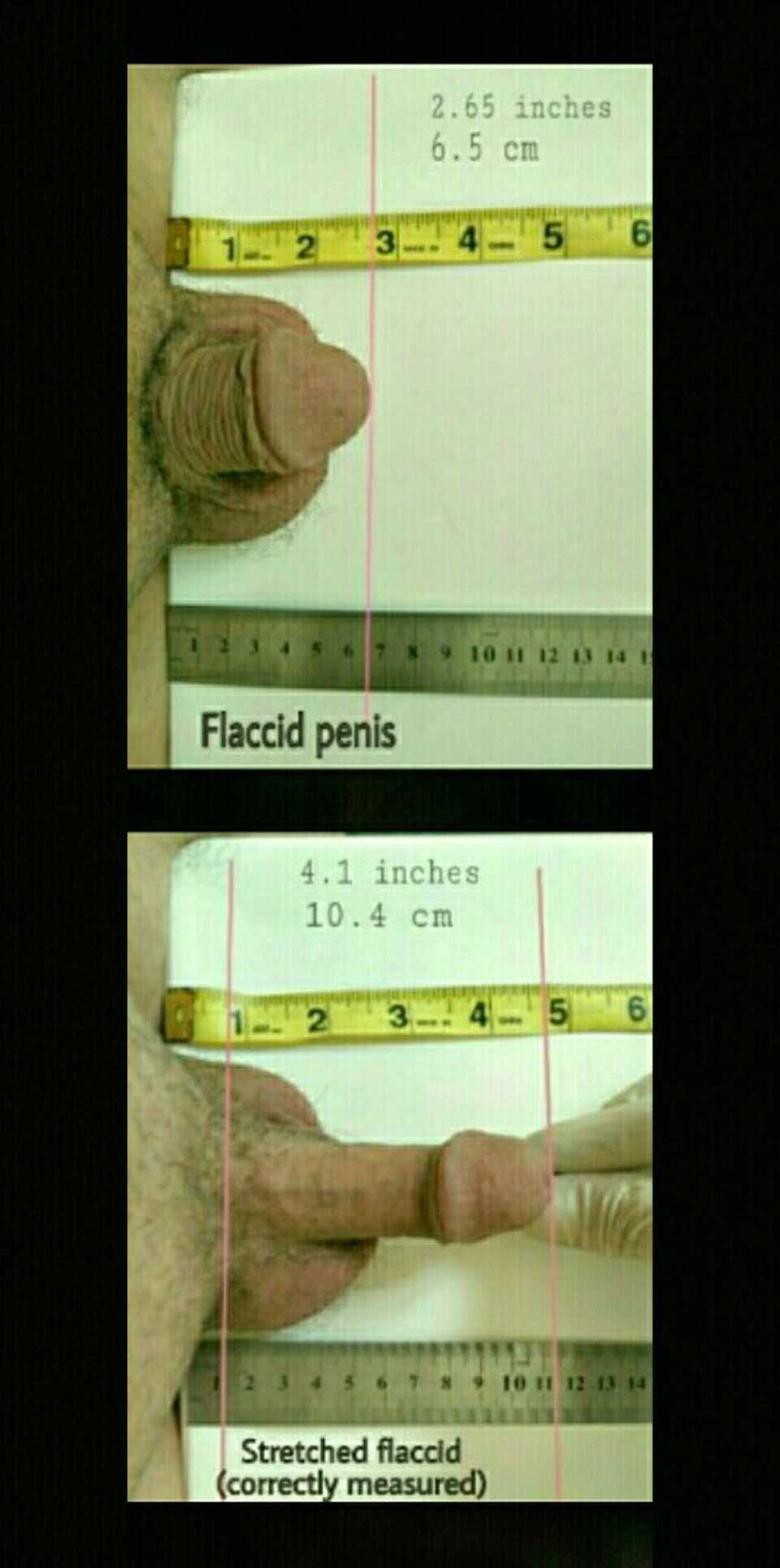 Foto Penis Size