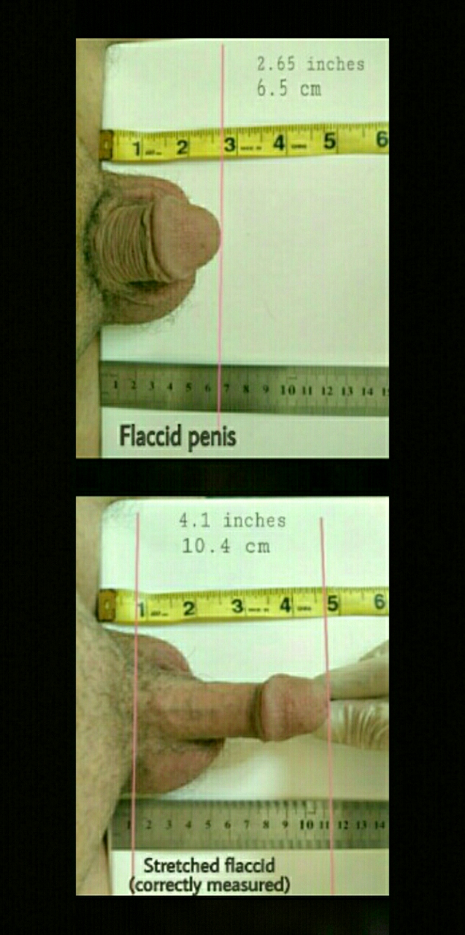 1 Inch Penis