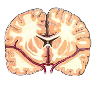 File:Arteriacerebral.jpg