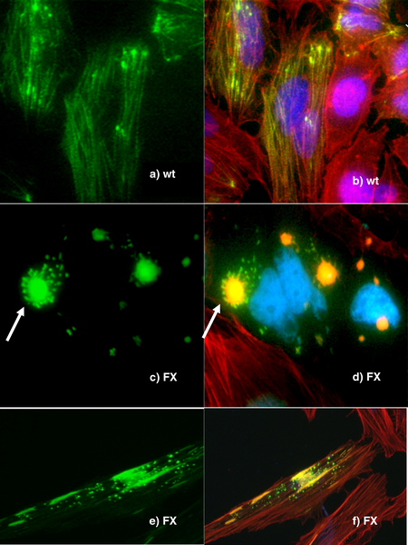 File:Expression of Human Wild-Type and P239S Mutant Palladin.png