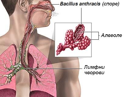 File:Inhalativ qarayara.sr.JPG