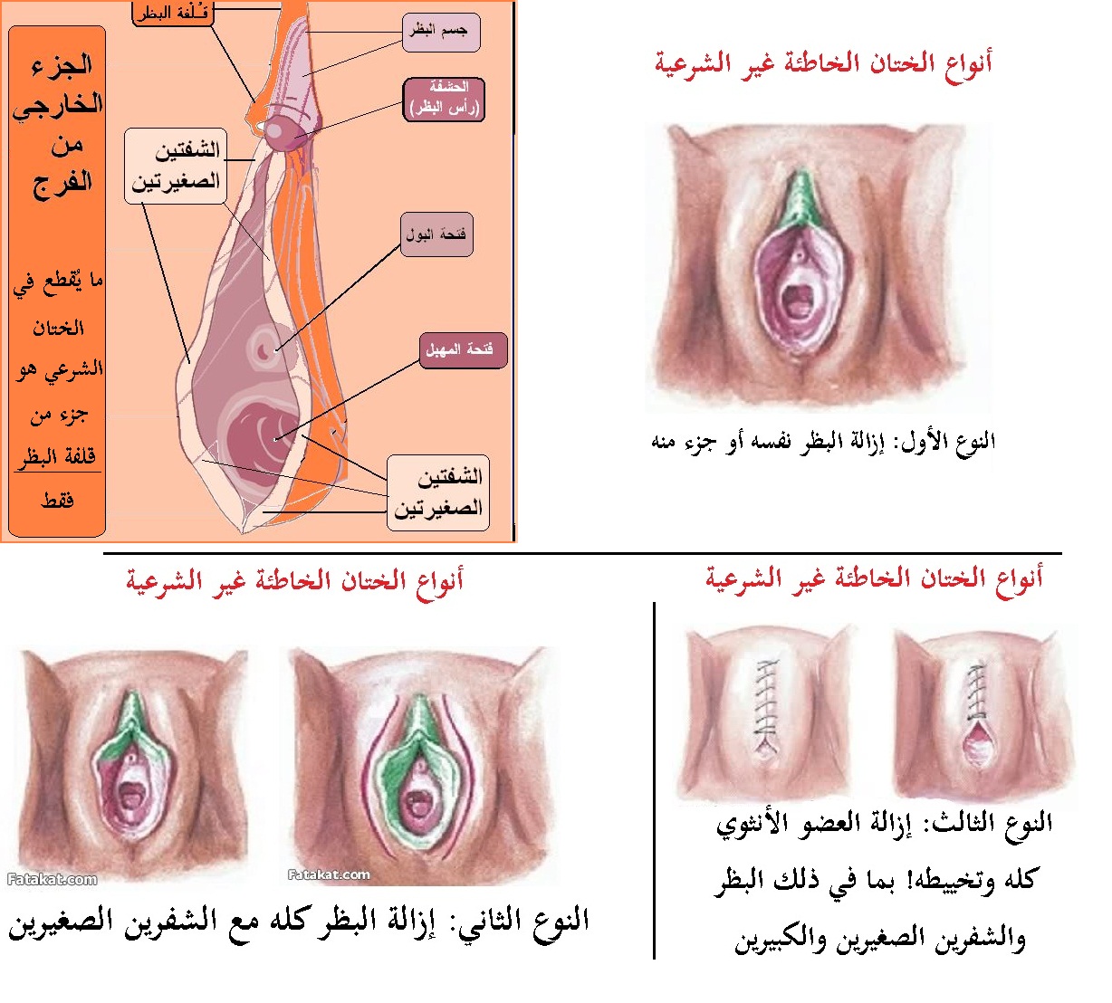 الجهاز التناسلي للمرأة الخارجي