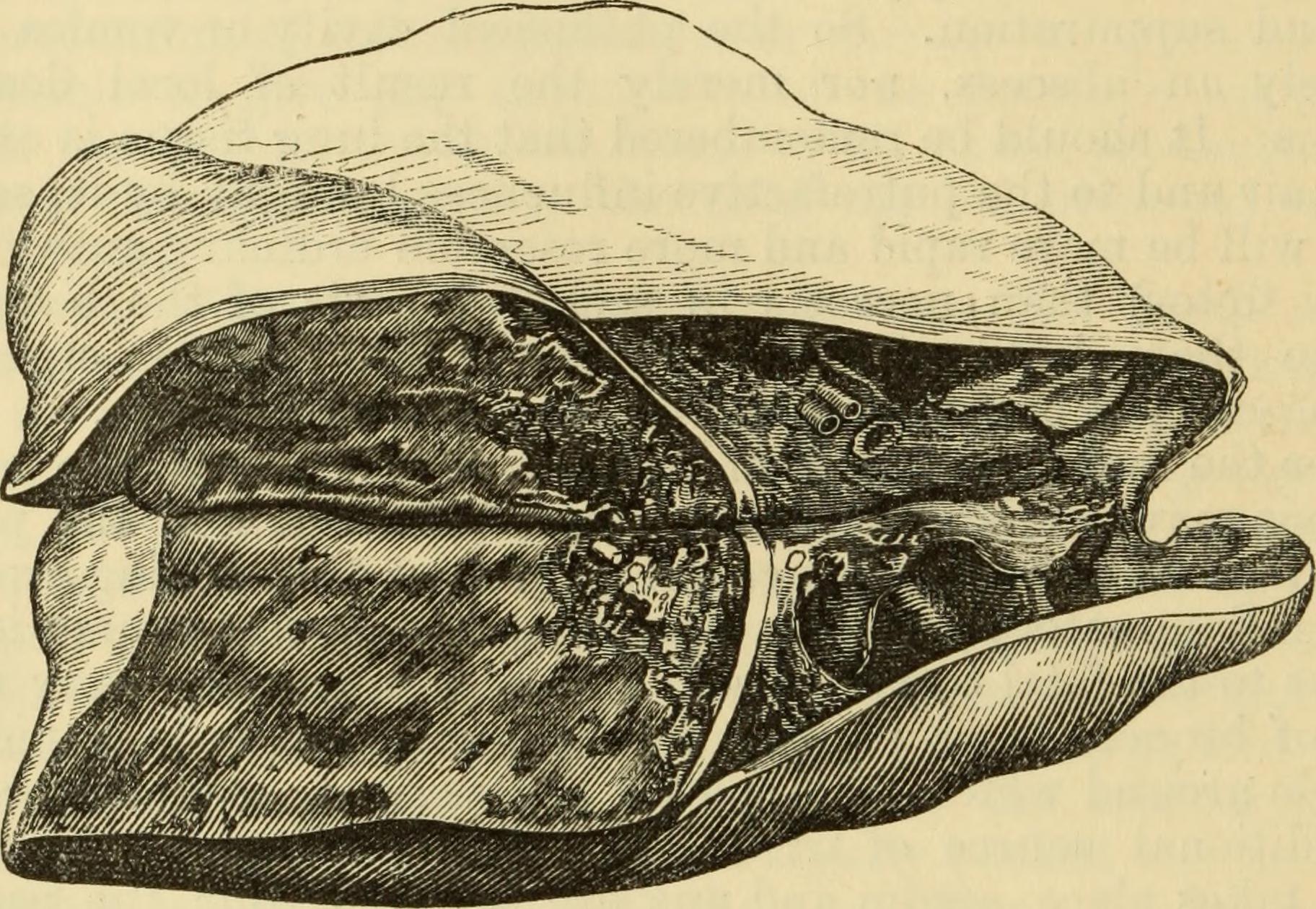 Pathological anatomy