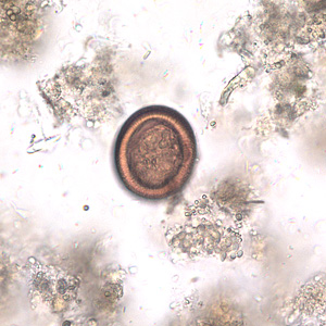 Echinococcus Egg